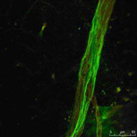 Image shows the muscle microcirculation labeled with a fluorescent marker.