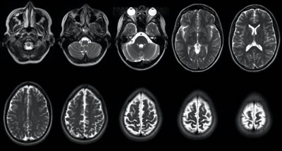 Brain Scans - Experimental Neuropsychology Research Unit