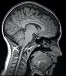 Brain Scans - Experimental Neuropsychology Research Unit
